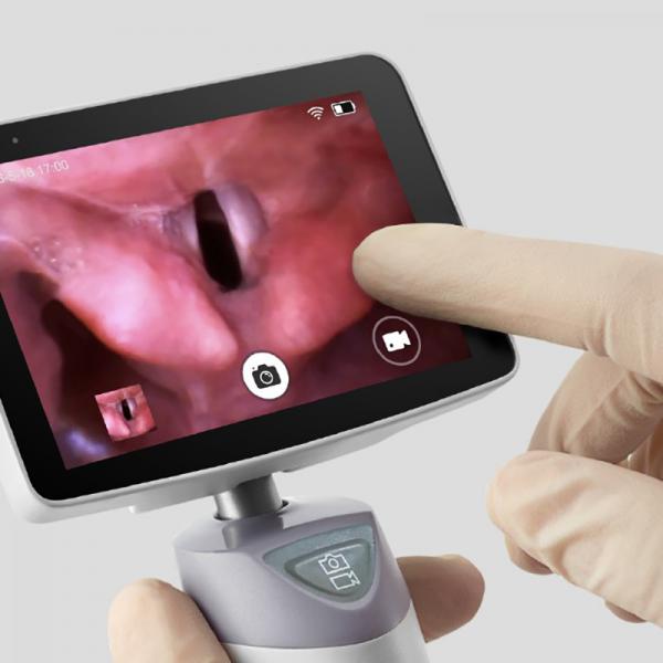 Video Laryngoscope